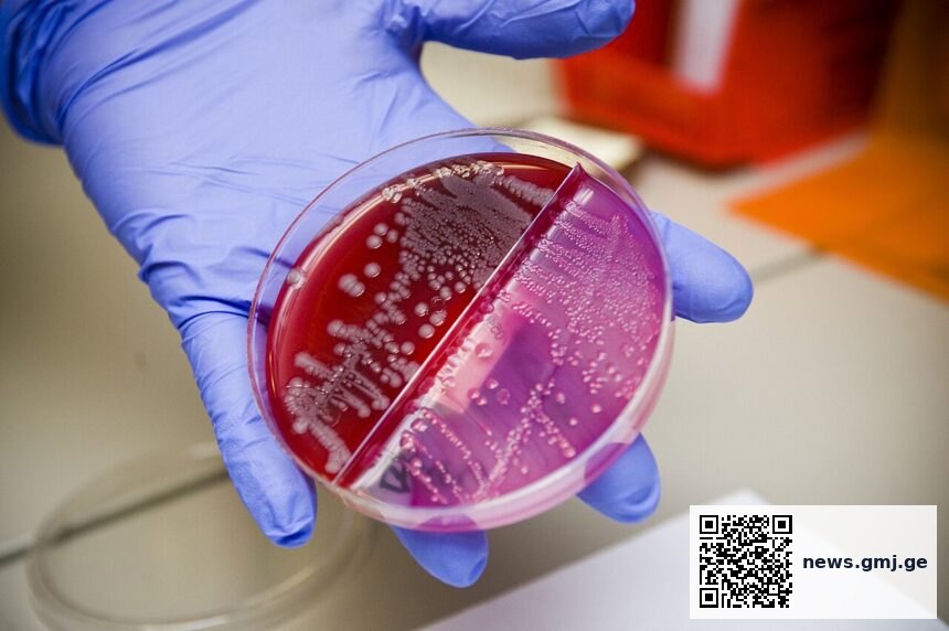 Microscopic image of chromoblastomycosis showing characteristic sclerotic bodies in skin tissue