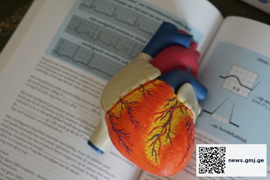 Comparison of thiamine deficiency rates in heart failure patients versus controls, showing 33% versus 12%