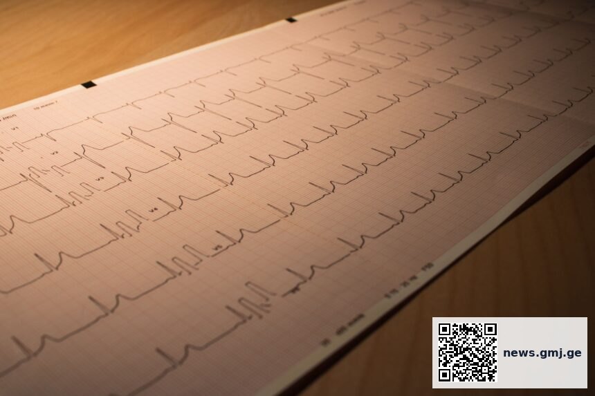 Artificial intelligence diagnostic imaging analysis of the heart showing advanced cardiac pathology identified for transplantation