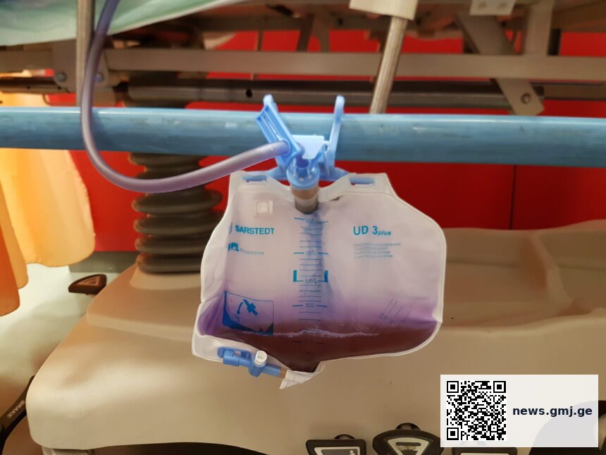 Medical illustration of urinary catheter system and bacterial metabolic pathways