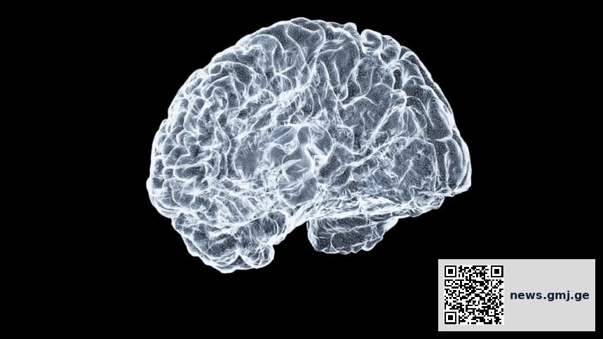 Brain scan showing auditory and somatosensory cortex activation during speech learning task