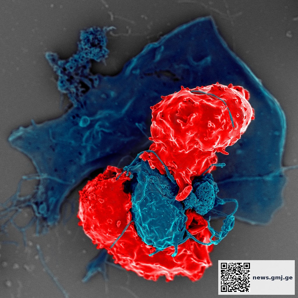 Illustration of regulatory T cells suppressing autoimmune inflammation through multiple mechanisms including cytokine secretion and dendritic cell reprogramming