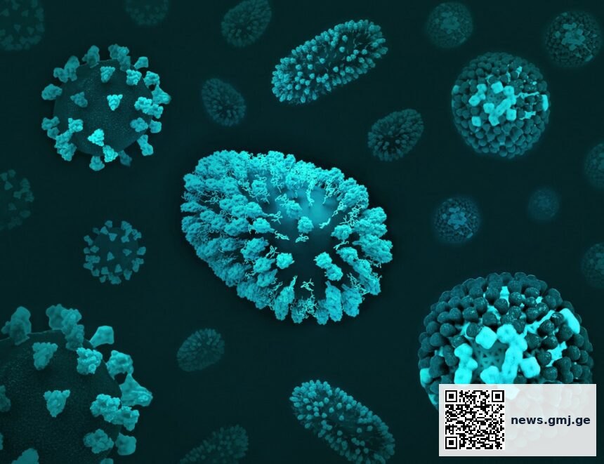 Illustration of foamy macrophage cells laden with lipid droplets in brain tissue during multiple sclerosis