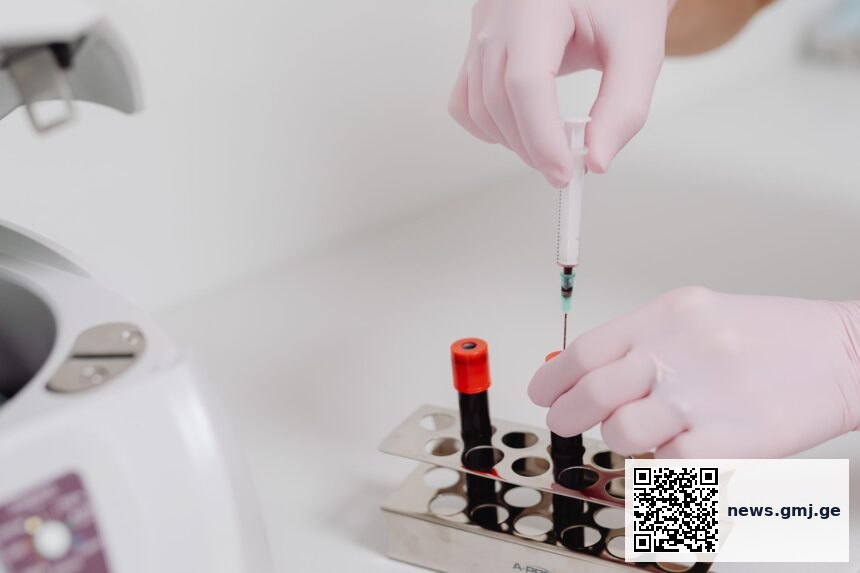 Mass spectrometry metabolomic analysis identifying histidine as immunotherapy survival predictor