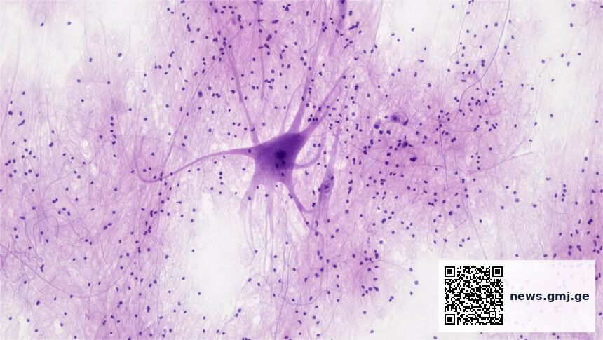 Illustration of tubulin proteins redirecting tau and alpha-synuclein away from toxic clumps in neurons