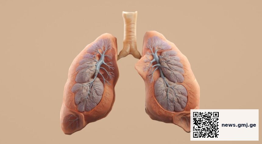 Chest X-ray showing pulmonary fibrosis pattern; abstract medical background